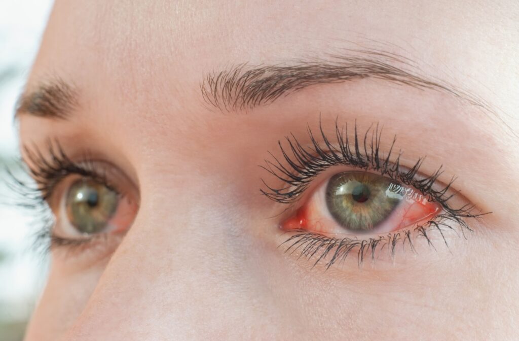 Close-up of a woman's green eyes with visible redness and irritation, showing long eyelashes and natural eyebrows.