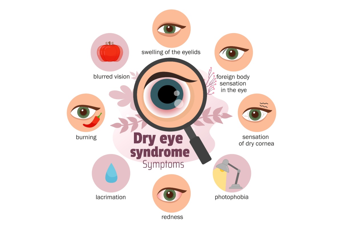 Educational infographic showing dry eye syndrome symptoms in circular layout with magnifying glass focusing on eye, displaying eight common symptoms: blurred vision, eyelid swelling, foreign body sensation, dry cornea sensation, photophobia, redness, excessive tearing (lacrimation), and burning sensation.